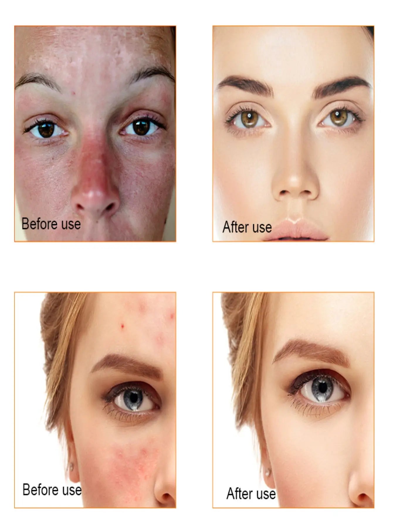 TRSTAY Vitamin C Serum For Face Moisturizing Brightens Skin Repair